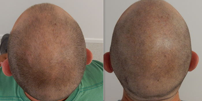 index.php/fa/32445/0/