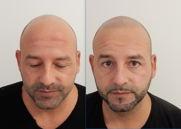 index.php/fa/32542/0/