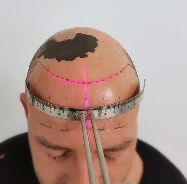 index.php/fa/32543/0/