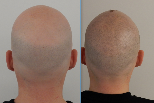 index.php/fa/32737/0/