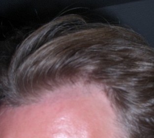 index.php/fa/3274/0/