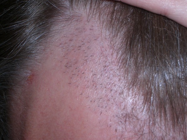 index.php/fa/3277/0/