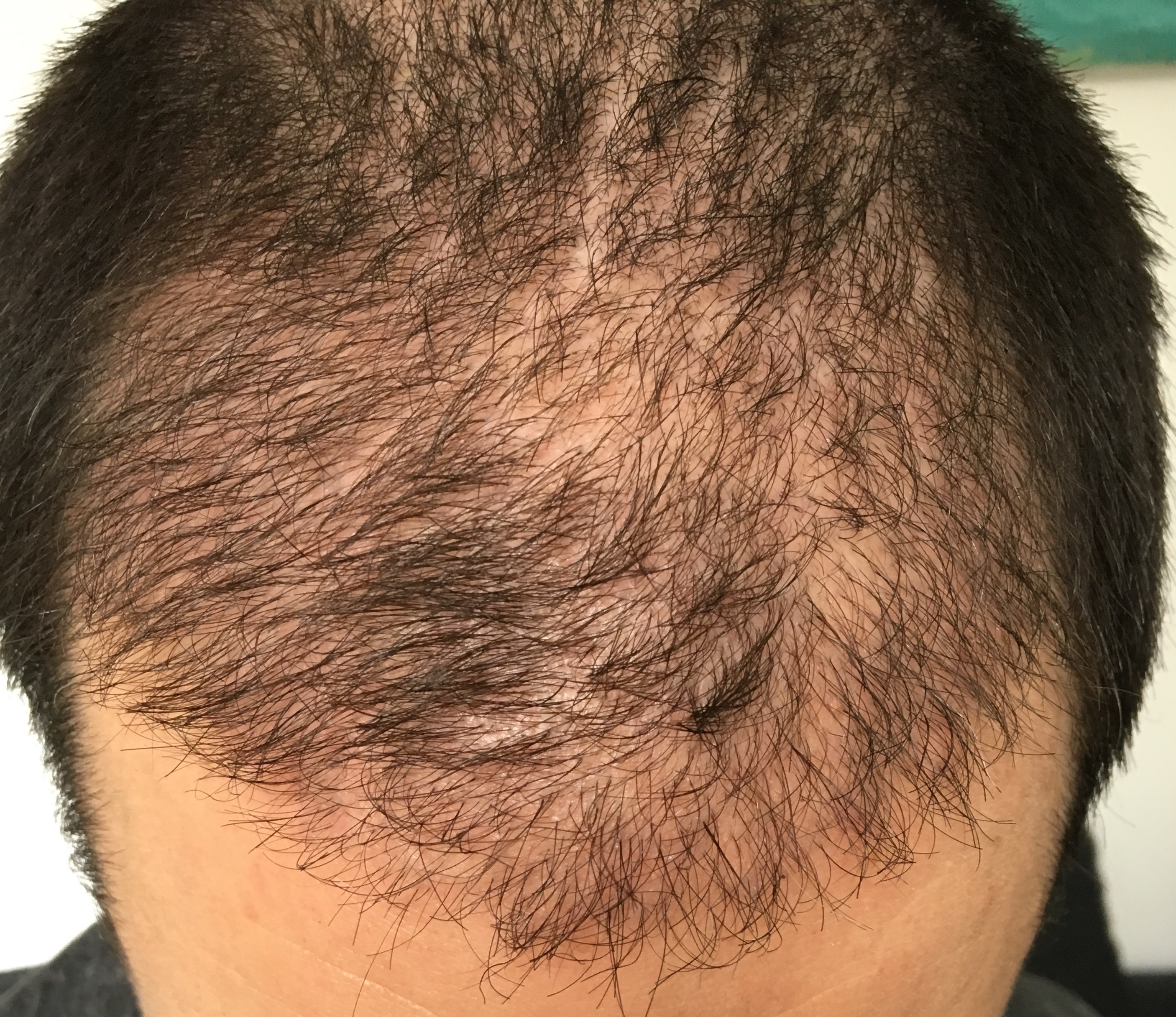 index.php/fa/32835/0/