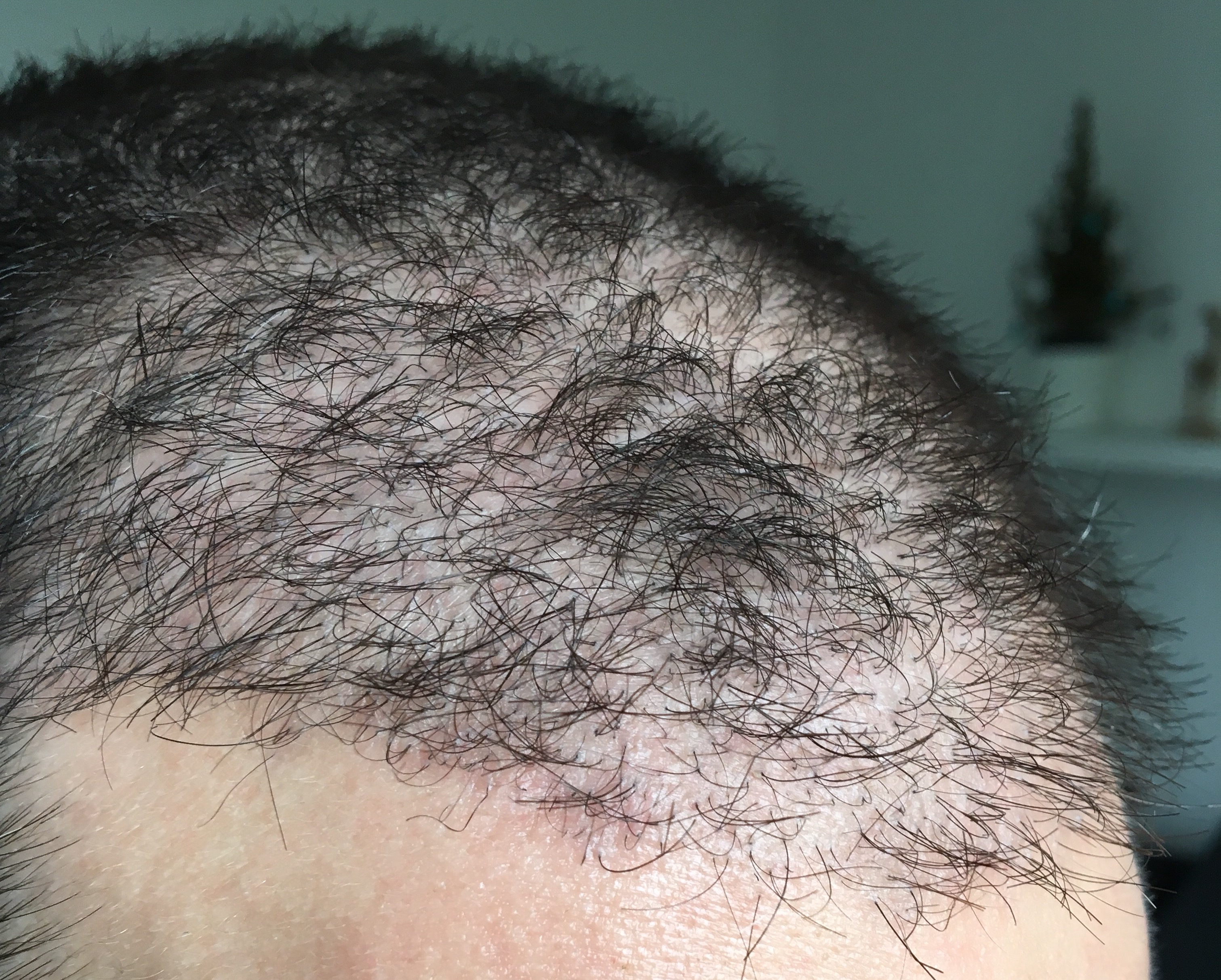 index.php/fa/32836/0/