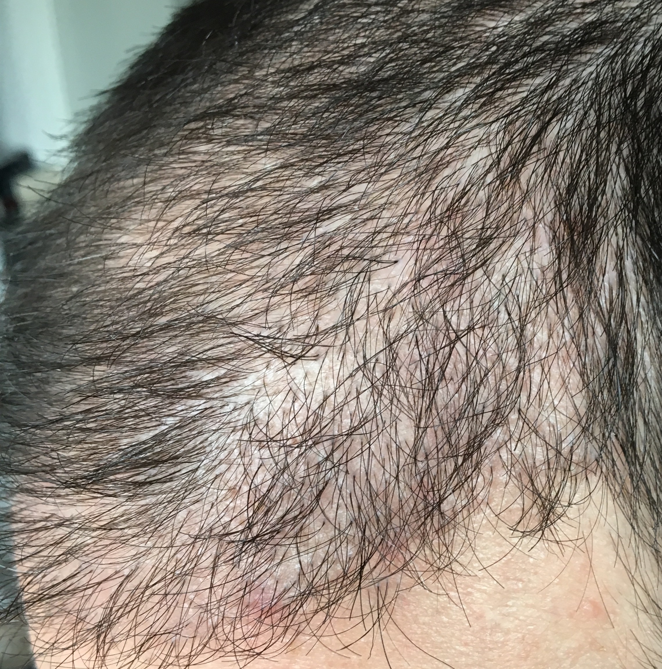 index.php/fa/32837/0/