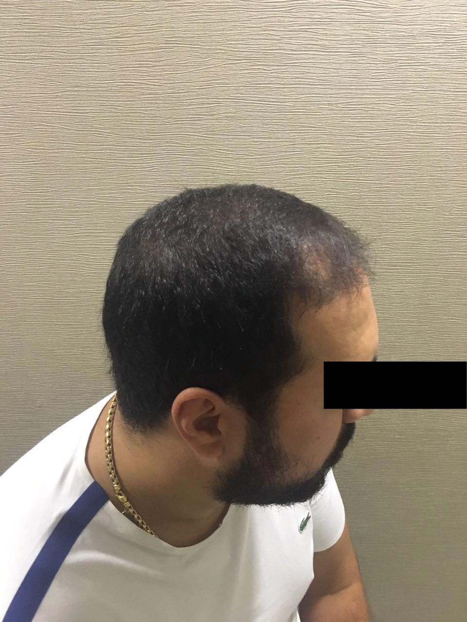 index.php/fa/32839/0/