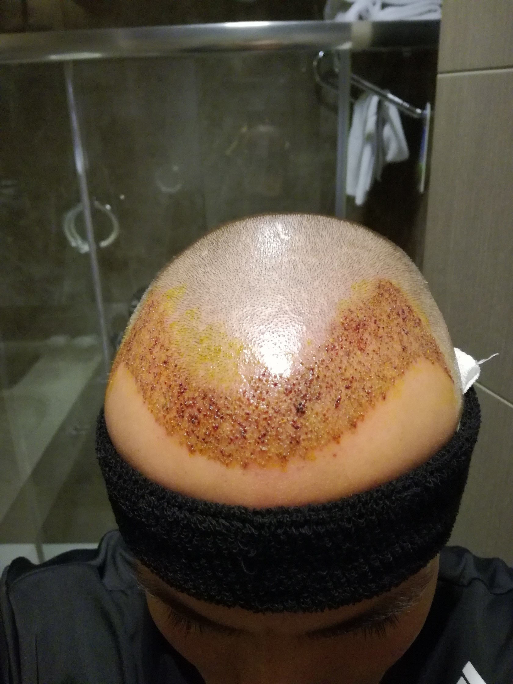 index.php/fa/32849/0/