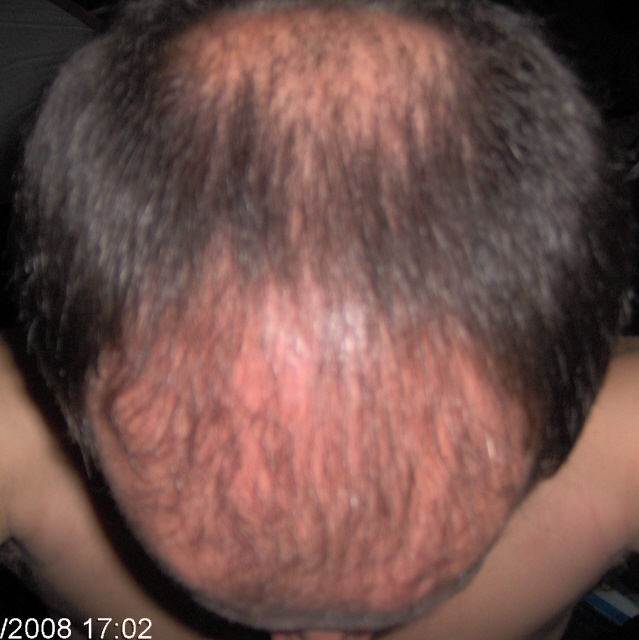 index.php/fa/3285/0/