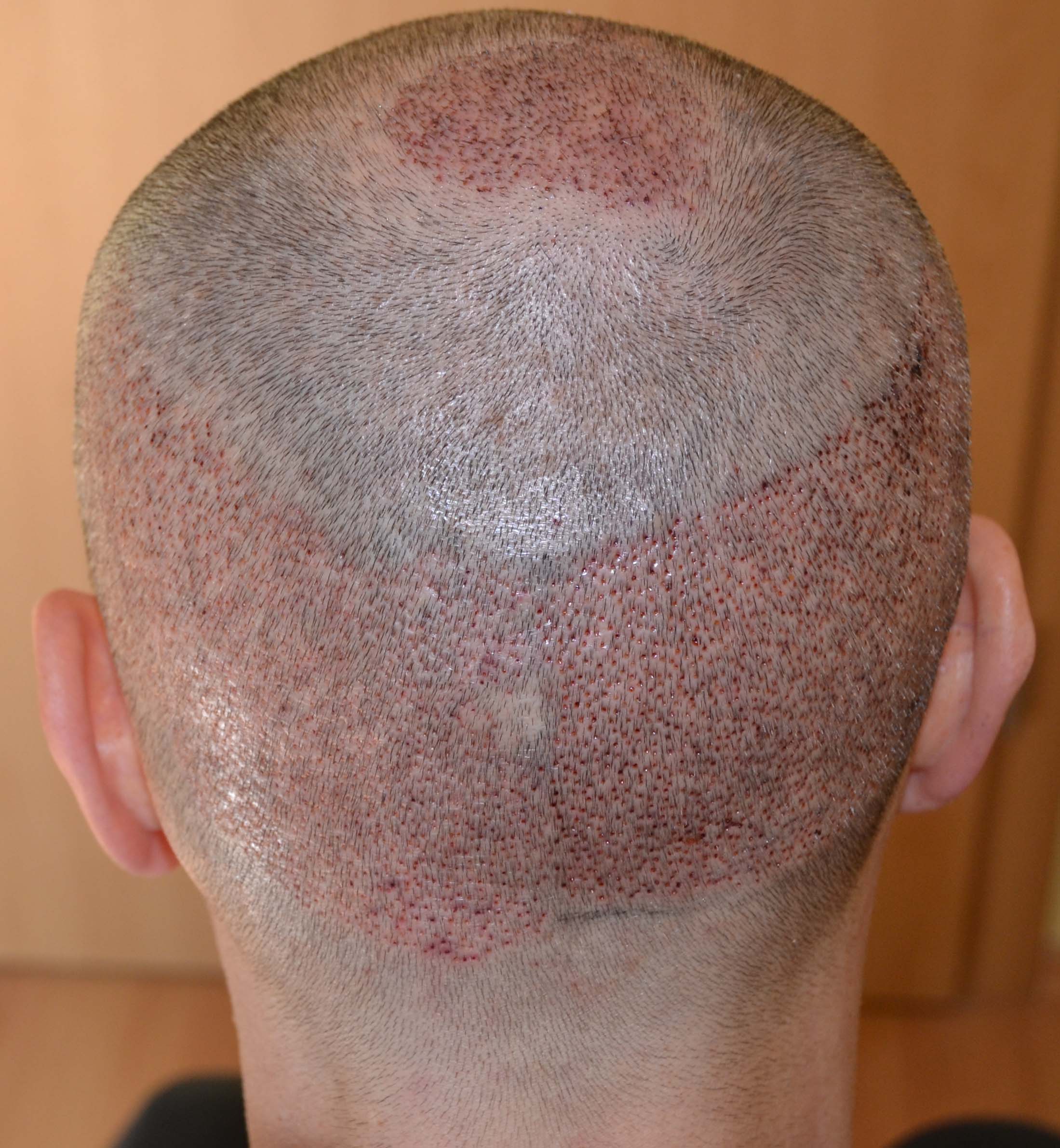 index.php/fa/32962/0/