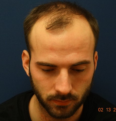 index.php/fa/32975/0/