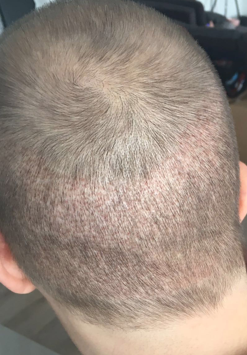 index.php/fa/32990/0/