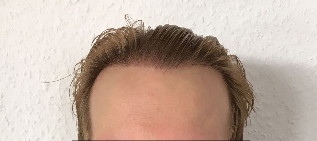 index.php/fa/32998/0/