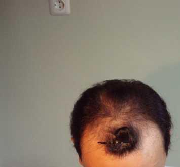 index.php/fa/3304/0/