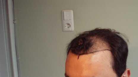 index.php/fa/3305/0/