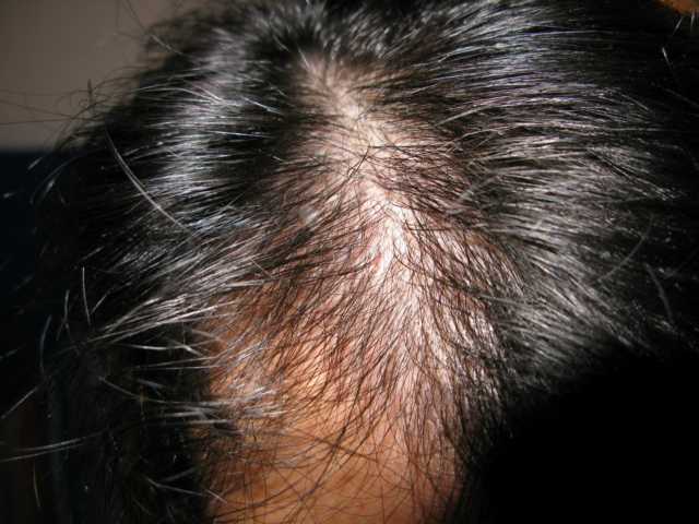 index.php/fa/3306/0/