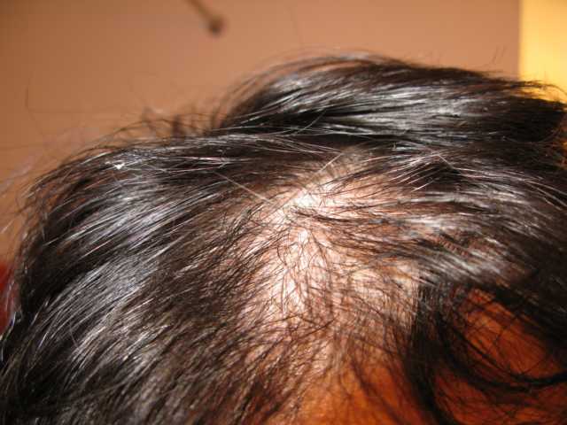 index.php/fa/3307/0/