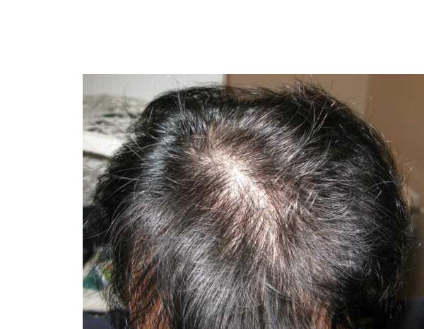 index.php/fa/3308/0/