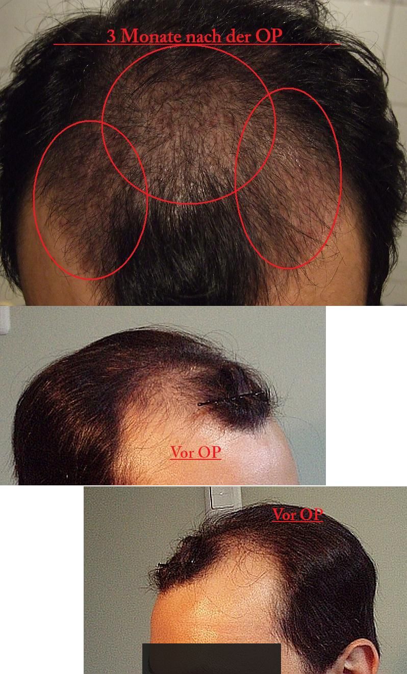 index.php/fa/3314/0/