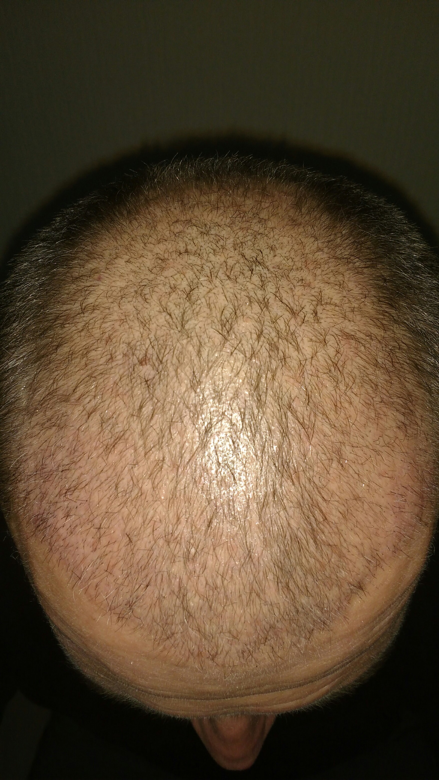 index.php/fa/33147/0/