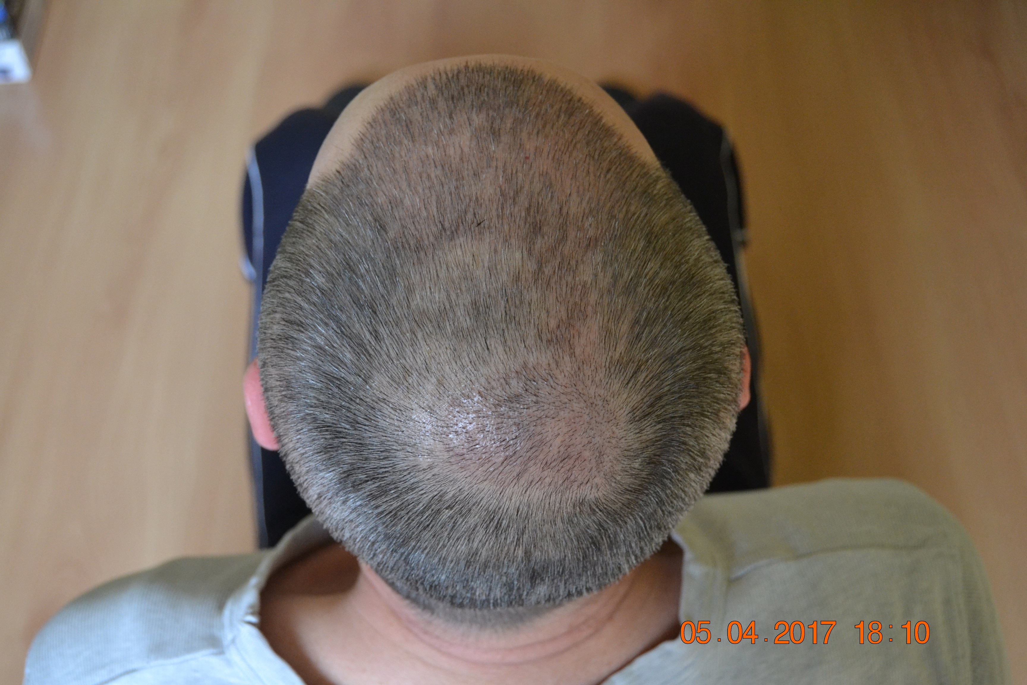 index.php/fa/33191/0/