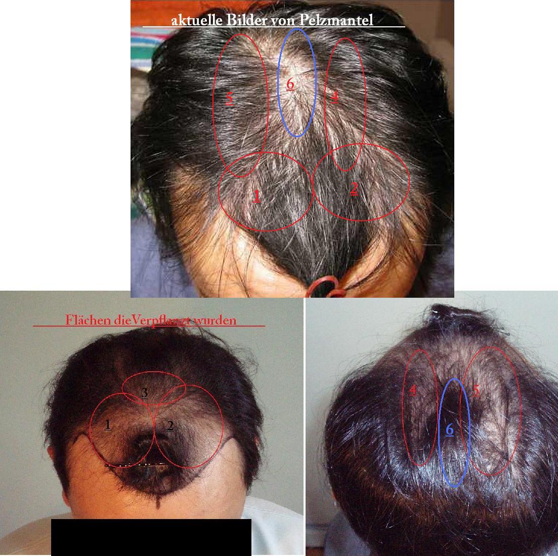 index.php/fa/3326/0/