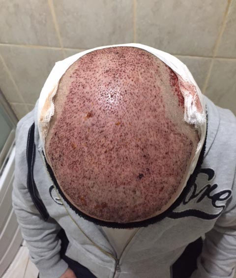 index.php/fa/33378/0/