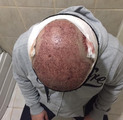 index.php/fa/33379/0/