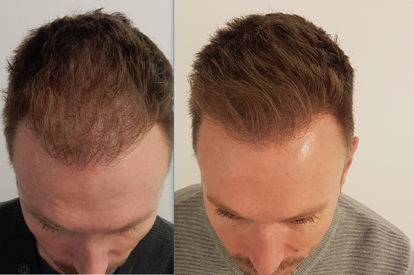 index.php/fa/33391/0/