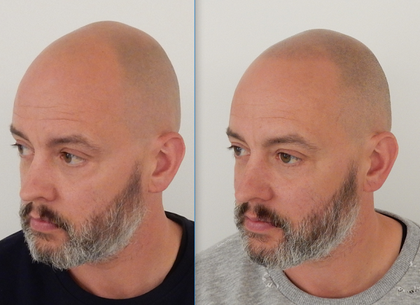 index.php/fa/33480/0/