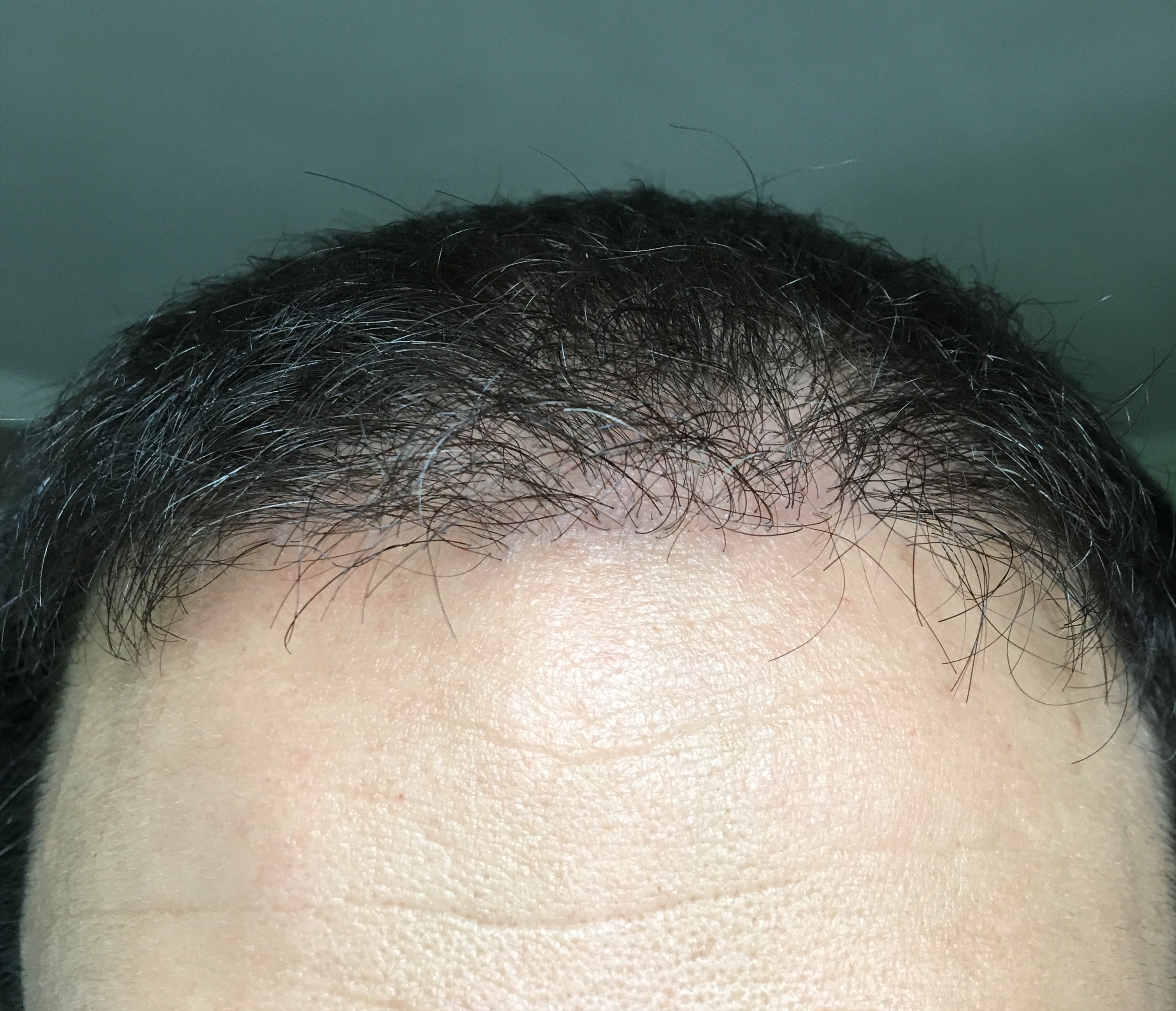 index.php/fa/33665/0/