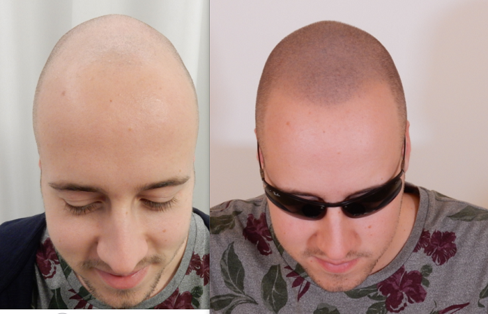 index.php/fa/33829/0/