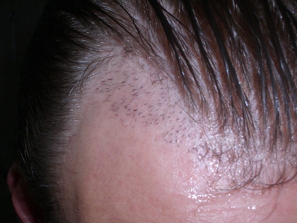 index.php/fa/3396/0/