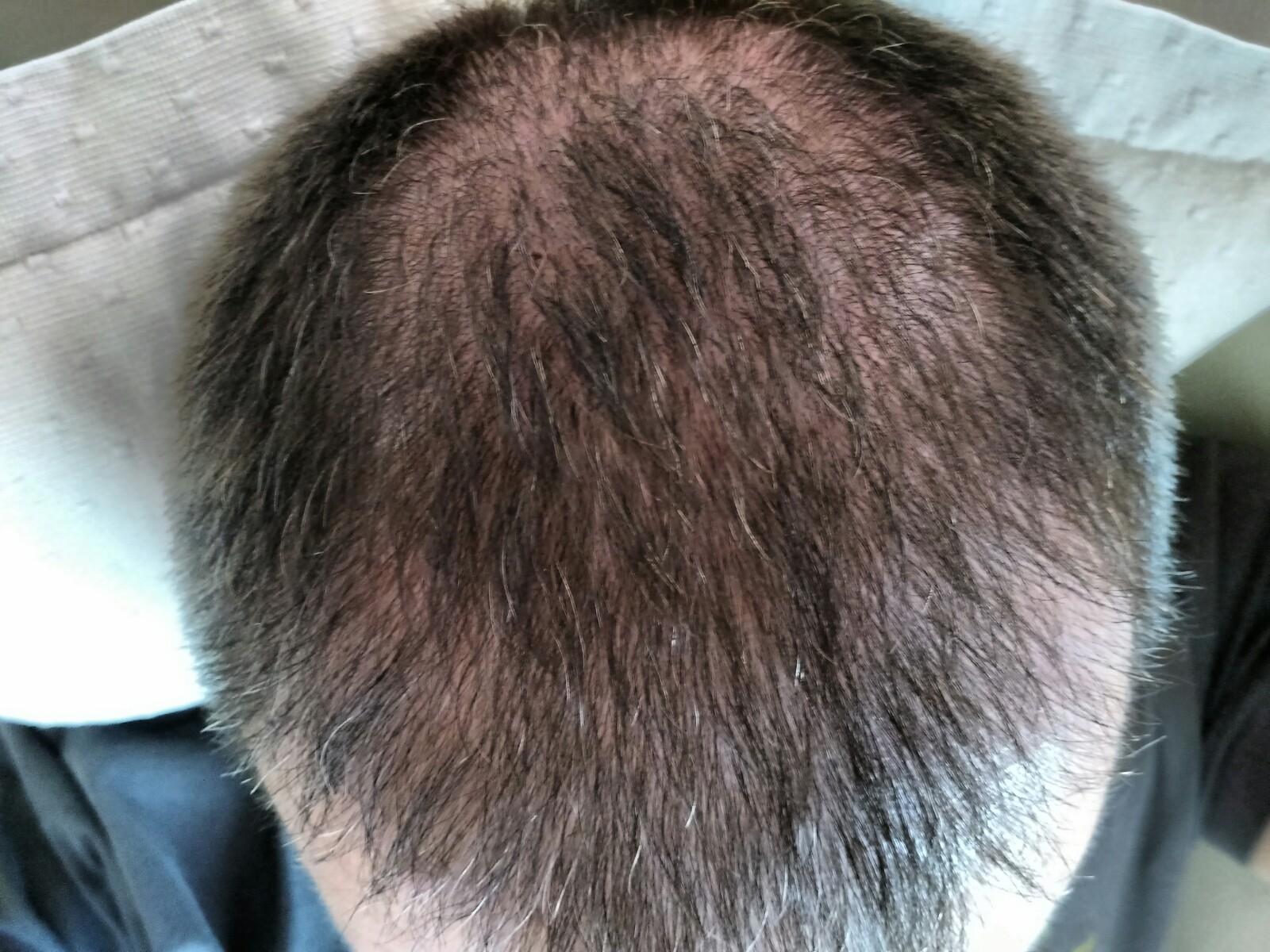 index.php/fa/33987/0/