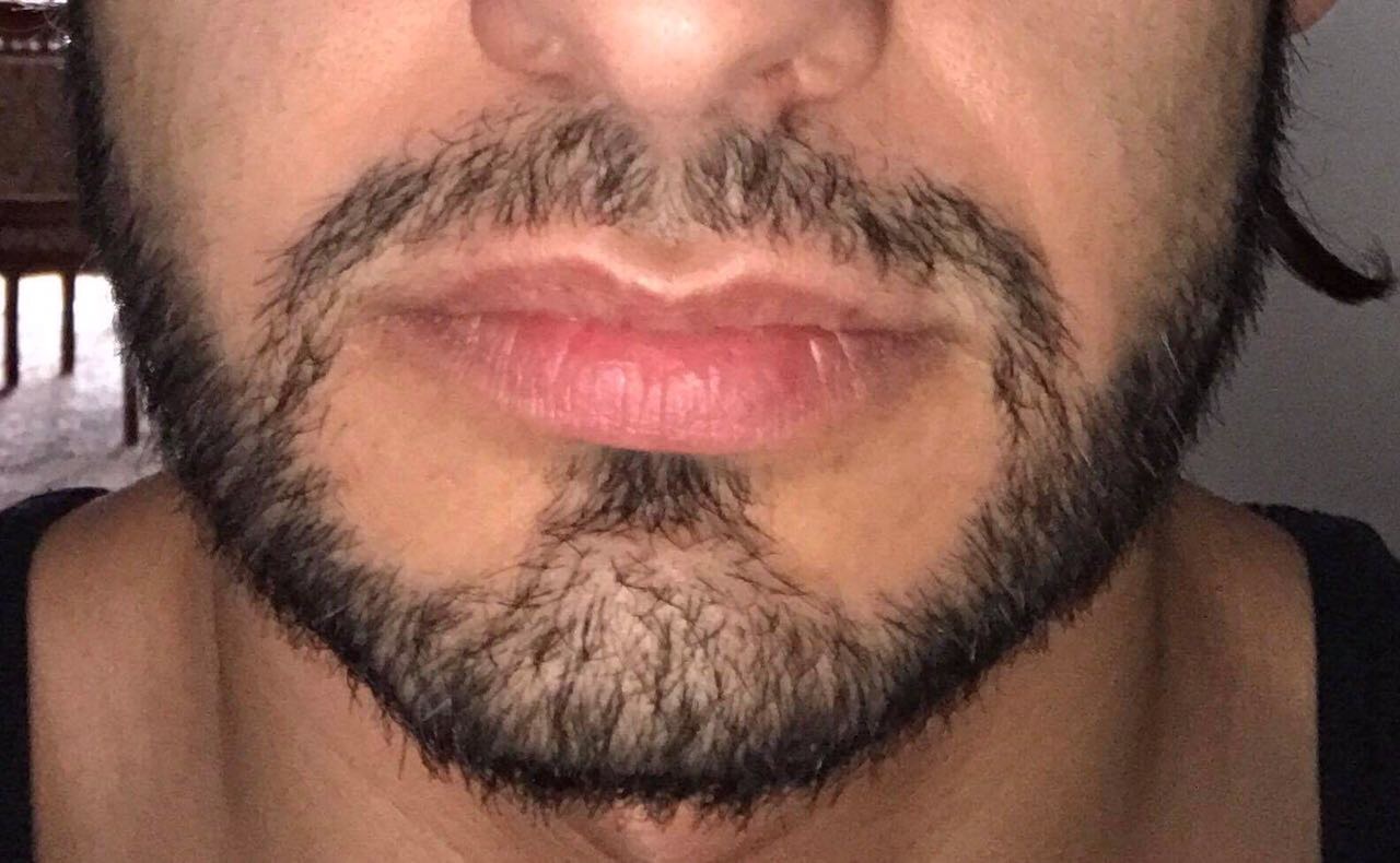 index.php/fa/33996/0/