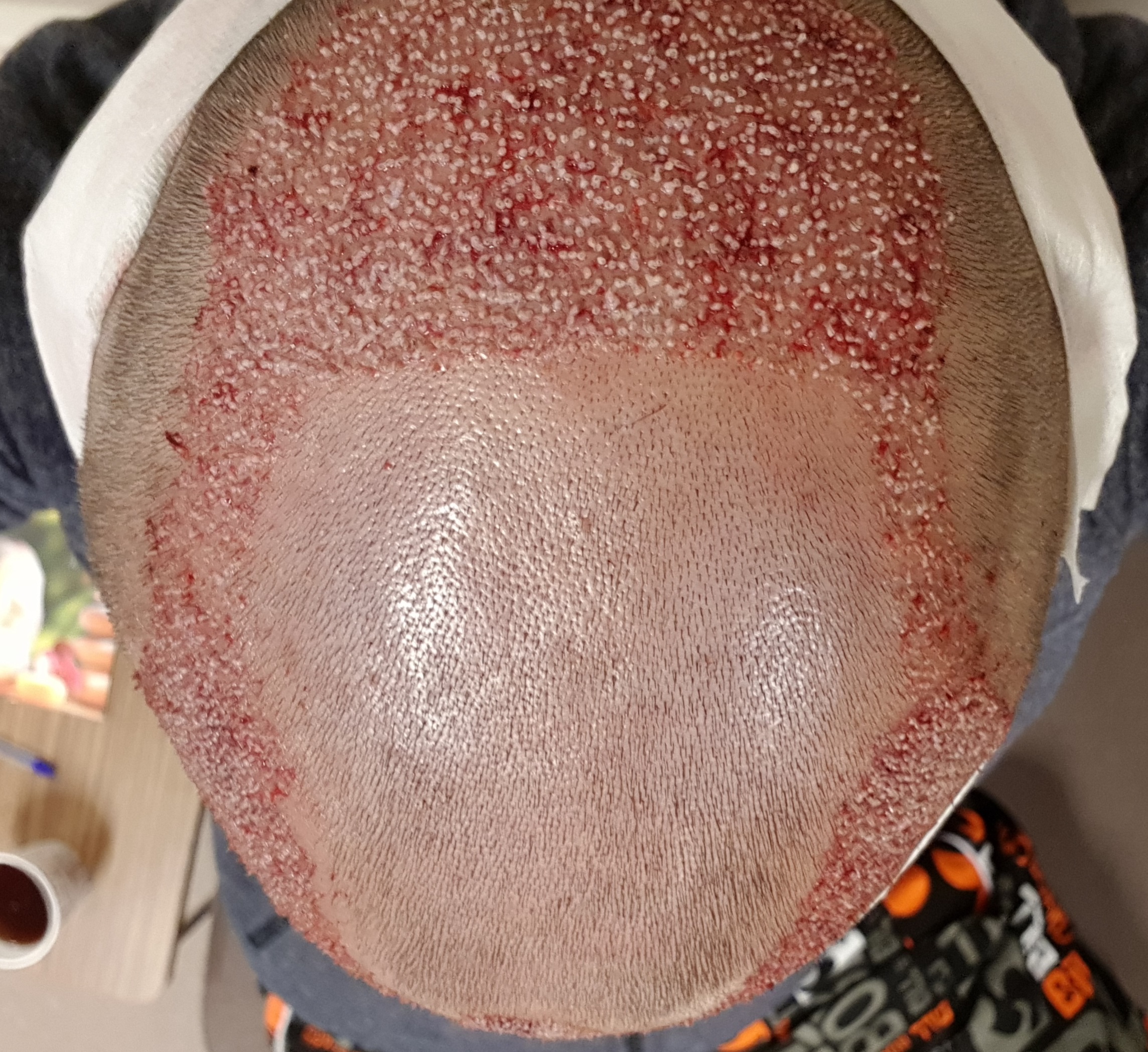 index.php/fa/34127/0/