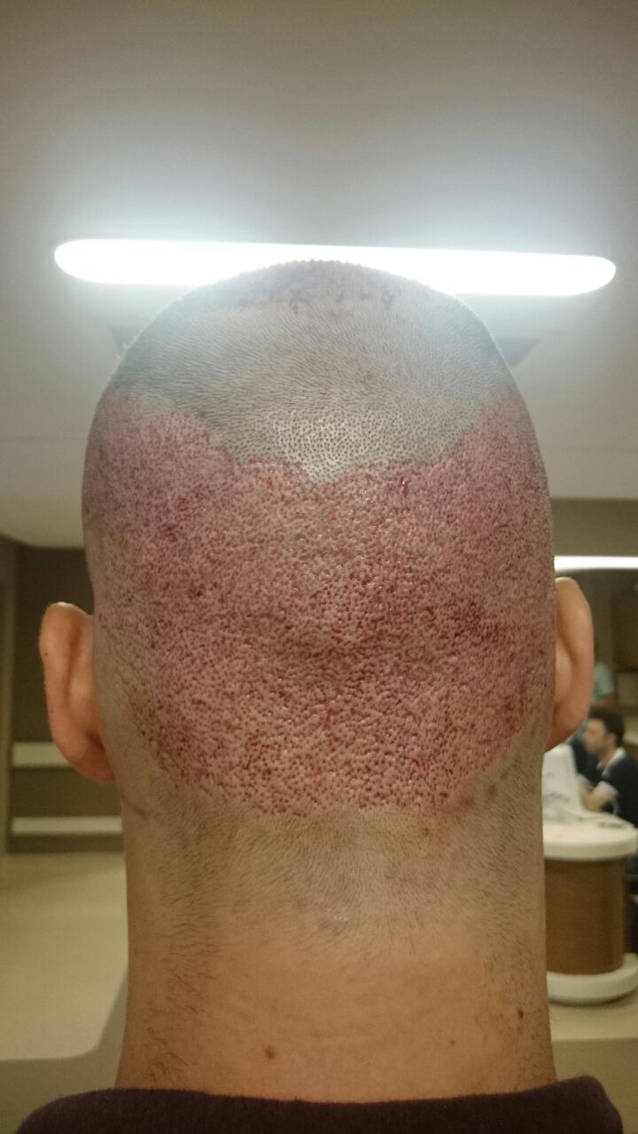 index.php/fa/34133/0/