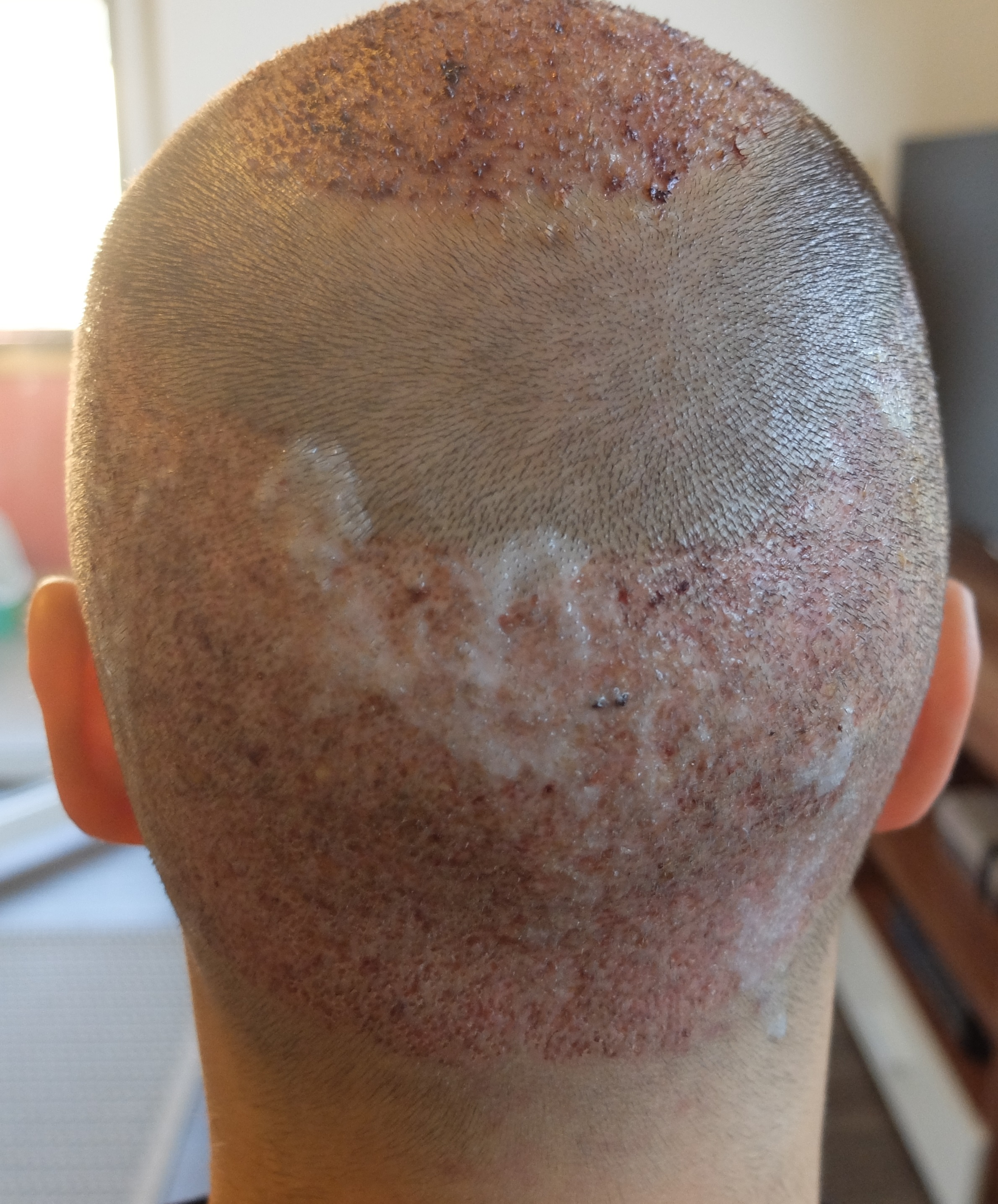 index.php/fa/34159/0/