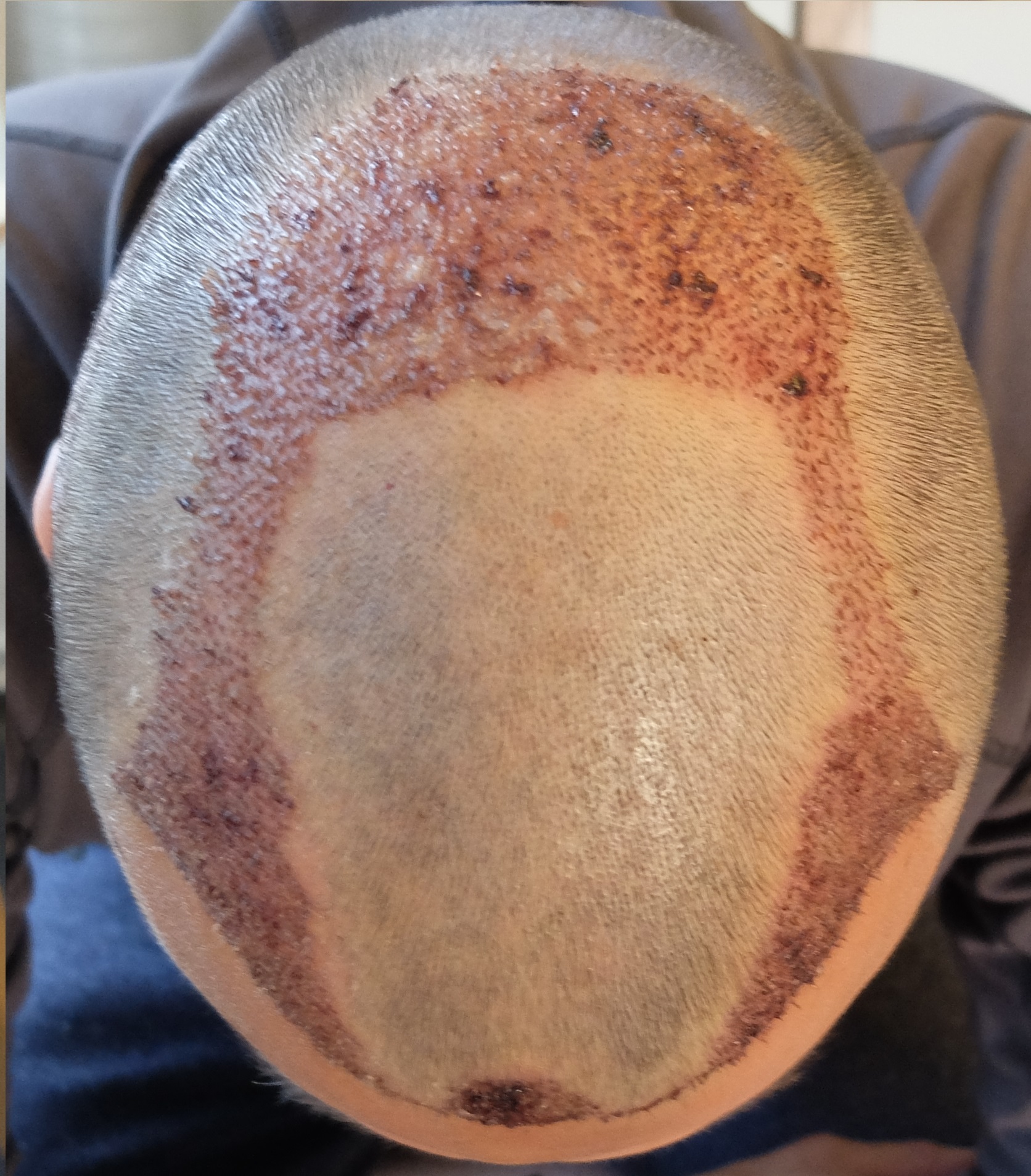 index.php/fa/34161/0/