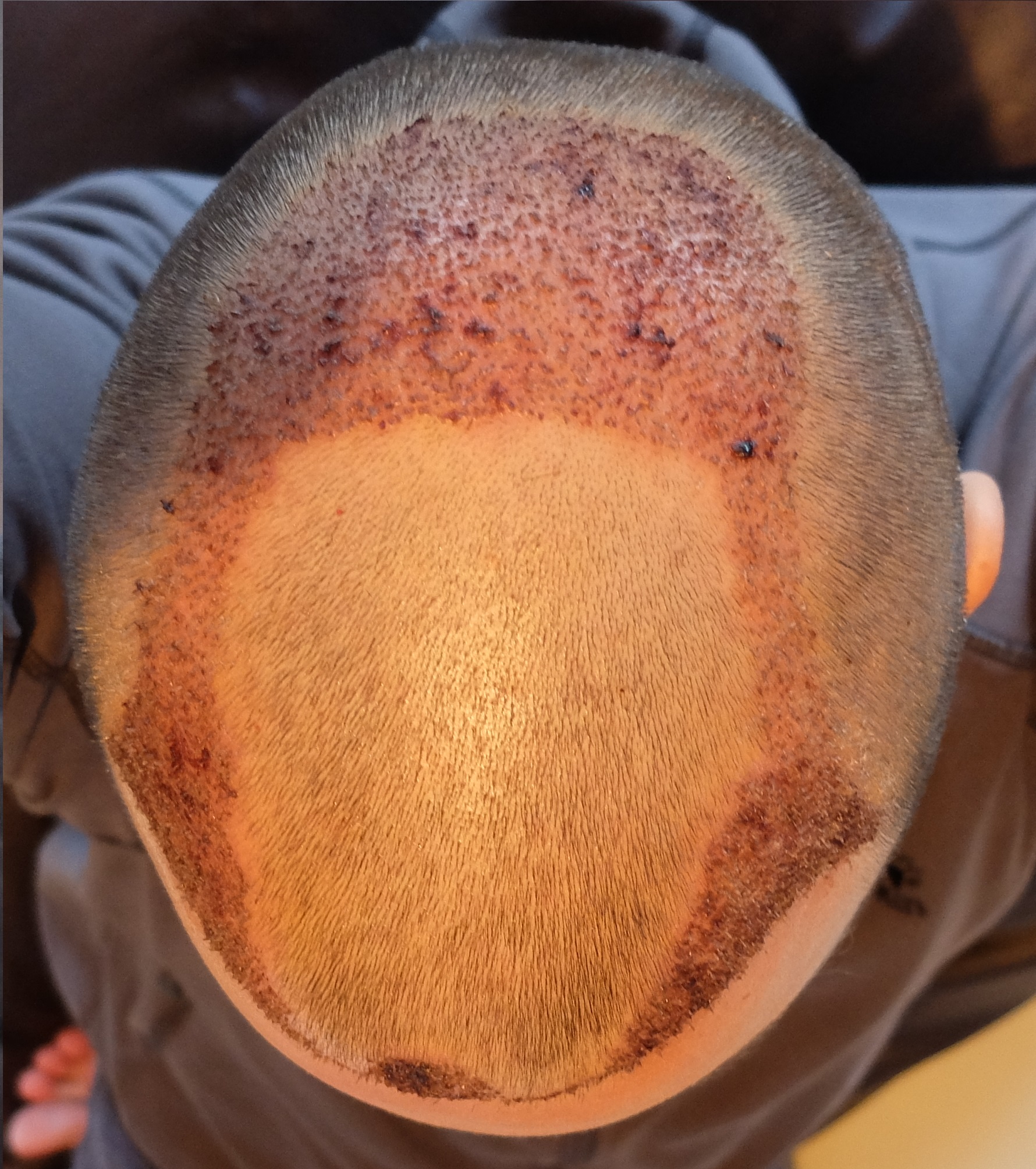 index.php/fa/34163/0/