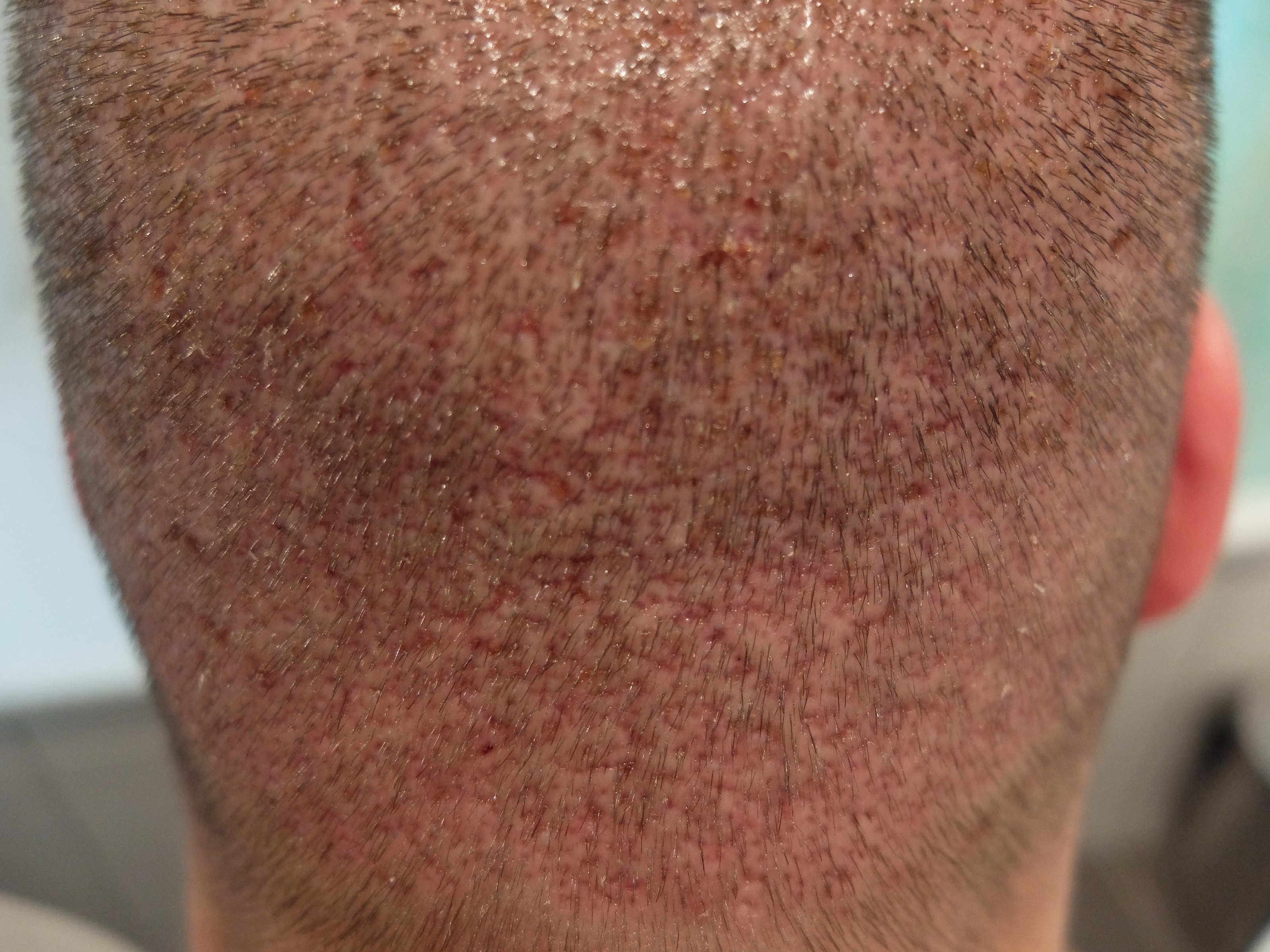 index.php/fa/34204/0/