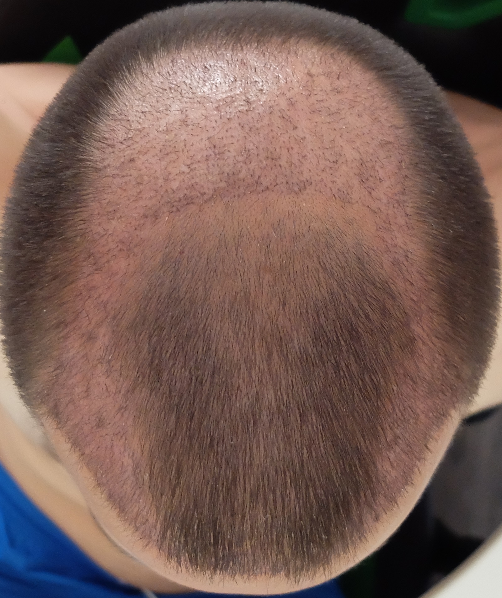 index.php/fa/34365/0/