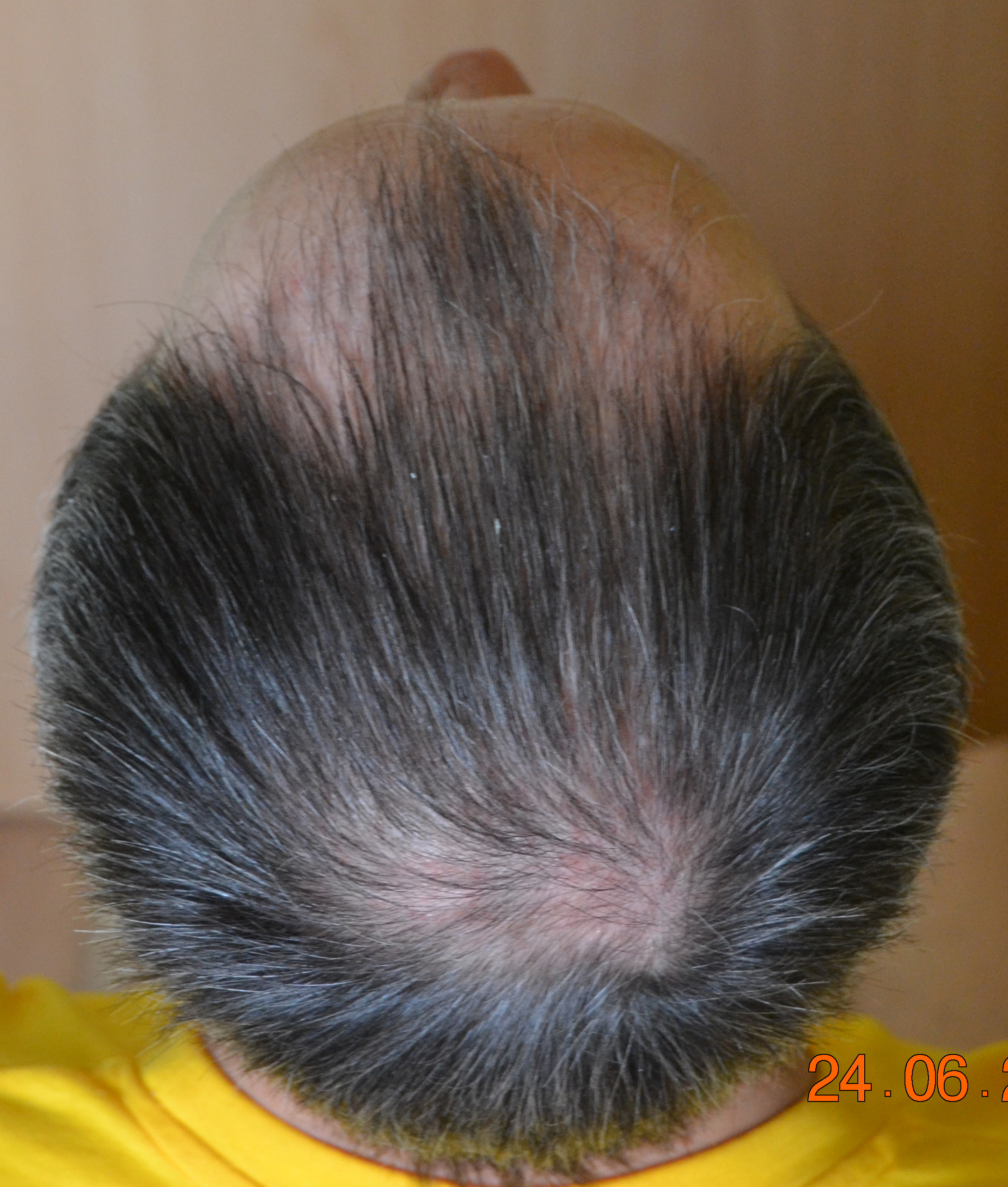 index.php/fa/34432/0/