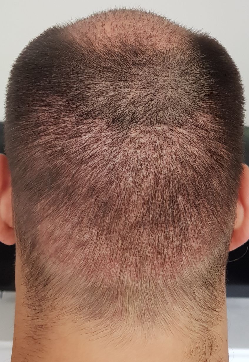 index.php/fa/34445/0/