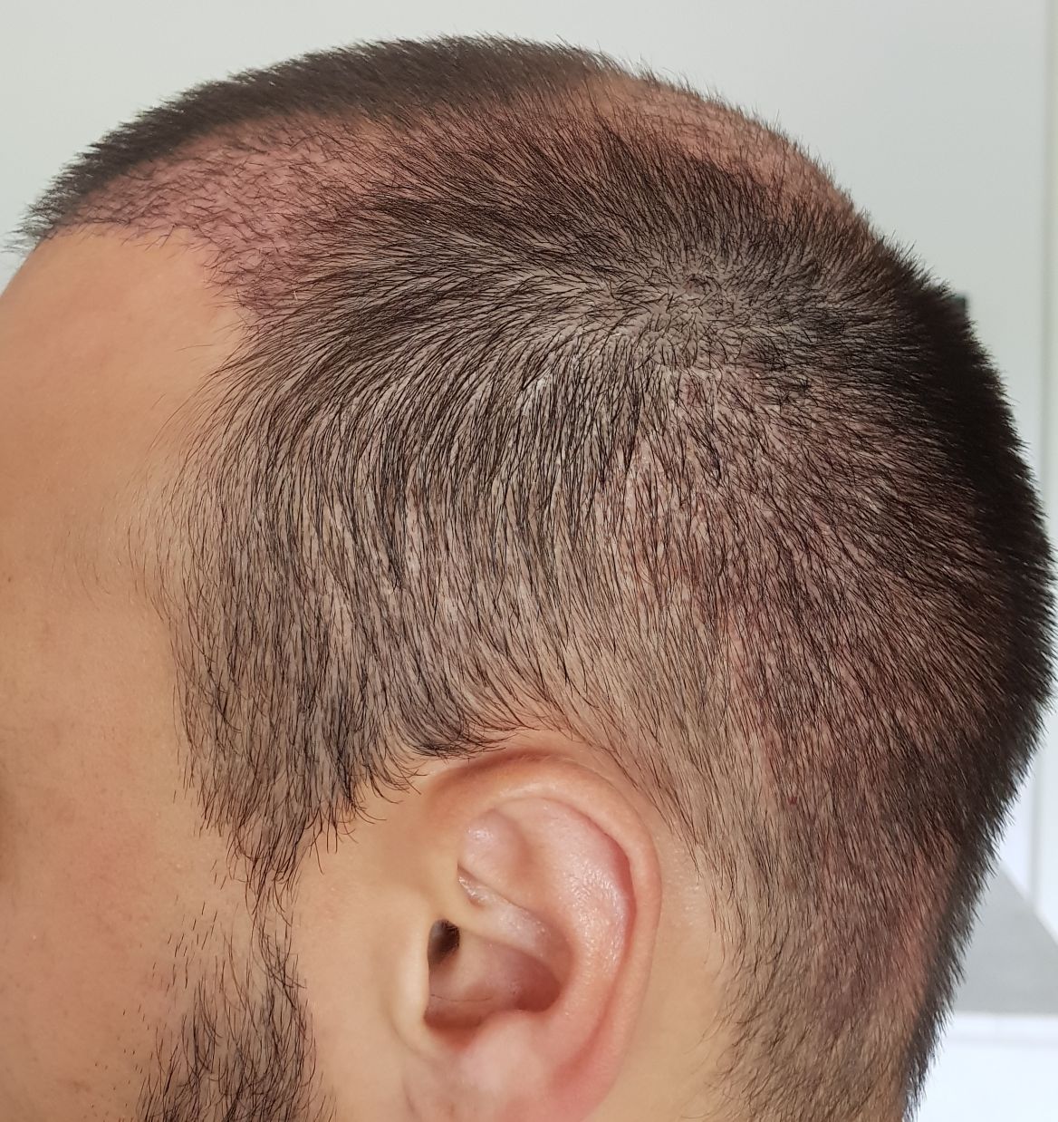 index.php/fa/34447/0/