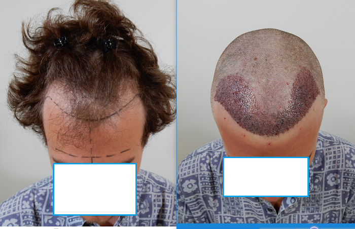 index.php/fa/34499/0/