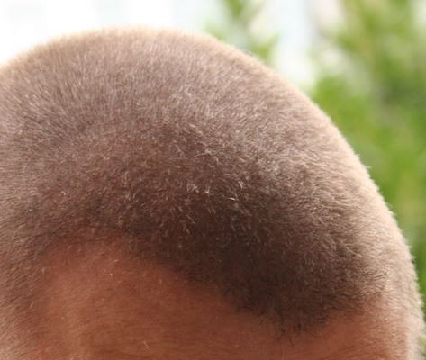 index.php/fa/3451/0/