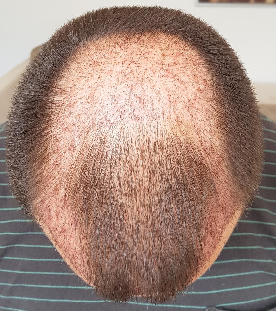 index.php/fa/34551/0/