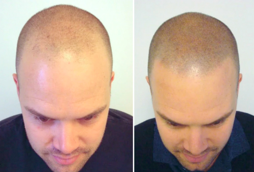 index.php/fa/34596/0/