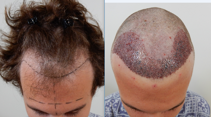 index.php/fa/34612/0/