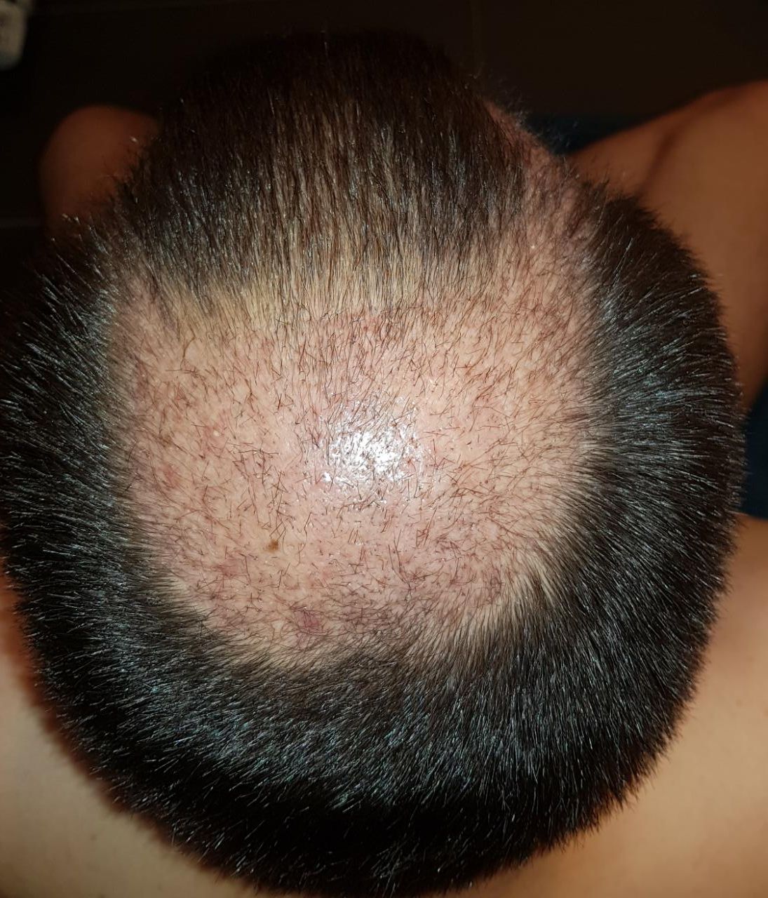 index.php/fa/34619/0/